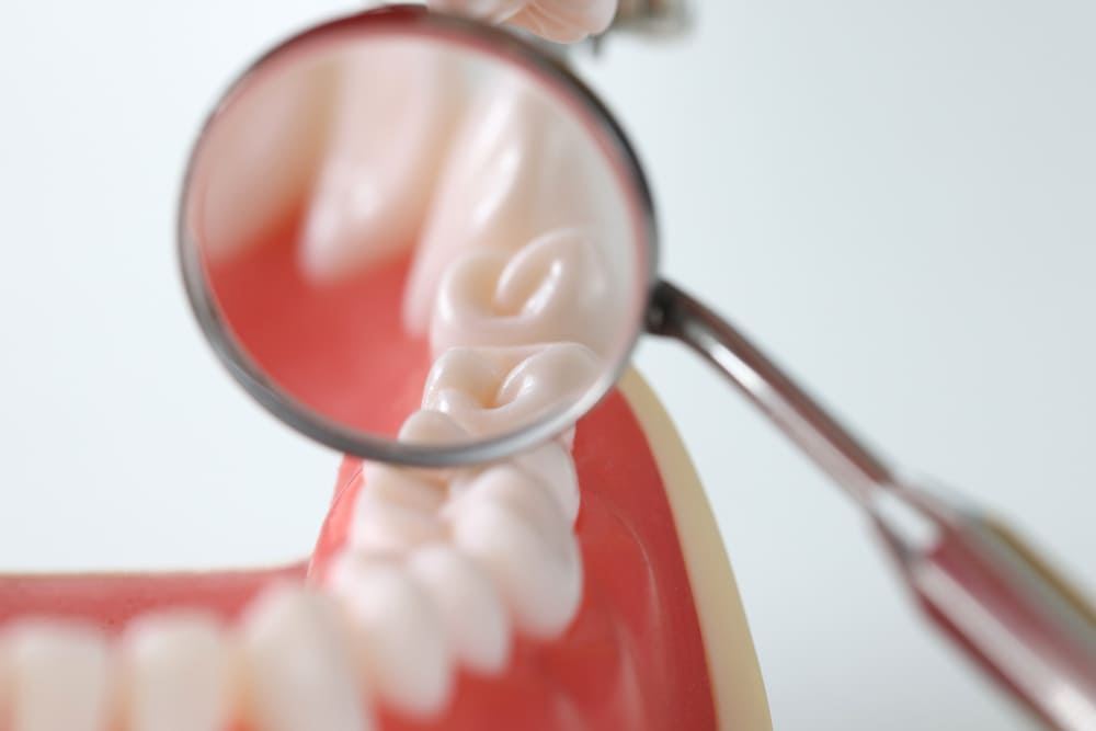 Inspección dental